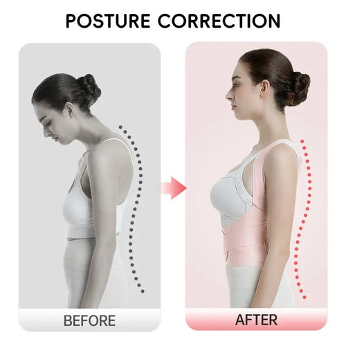 [DealsForYouDays] Posture Corrector for Women & Men